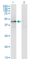 TEX28 Antibody - Western Blot analysis of TEX28 expression in transfected 293T cell line by TEX28 monoclonal antibody (M05), clone 1A8.Lane 1: TEX28 transfected lysate (Predicted MW: 46.1 KDa).Lane 2: Non-transfected lysate.