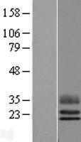 TEX29 / C13orf16 Protein - Western validation with an anti-DDK antibody * L: Control HEK293 lysate R: Over-expression lysate
