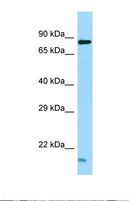 TEX35 / C1orf49 Antibody - Western blot of Human NCI-H226. Tex35 antibody dilution 1.0 ug/ml.  This image was taken for the unconjugated form of this product. Other forms have not been tested.