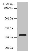 TEX35 / C1orf49 Antibody - Western blot All lanes: Tex35 antibody at 4µg/ml + U251 whole cell lysate Secondary Goat polyclonal to rabbit IgG at 1/10000 dilution Predicted band size: 27, 26, 24, 21, 25 kDa Observed band size: 27 kDa
