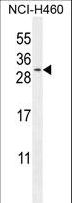 TEX37 / TSC21 Antibody - C2orf51 Antibody western blot of NCI-H460 cell line lysates (35 ug/lane). The C2orf51 antibody detected the C2orf51 protein (arrow).