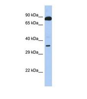 TEX9 Antibody - Western blot of Human 721_B. TEX9 antibody dilution 1.0 ug/ml.  This image was taken for the unconjugated form of this product. Other forms have not been tested.