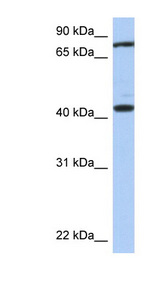 TEX9 Antibody - TEX9 antibody Western blot of Fetal Brain lysate. This image was taken for the unconjugated form of this product. Other forms have not been tested.