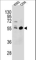 TEX9 Antibody - TEX9 Antibody western blot of K562,CEM cell line lysates (35 ug/lane). The TEX9 antibody detected the TEX9 protein (arrow).