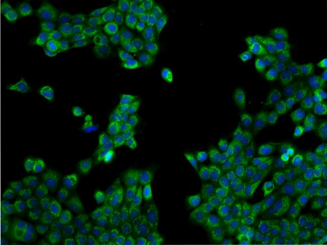 TEX9 Antibody - Immunofluorescence staining of TEX9 in A431 cells. Cells were fixed with 4% PFA, permeabilzed with 0.1% Triton X-100 in PBS, blocked with 10% serum, and incubated with rabbit anti-Human TEX9 polyclonal antibody (dilution ratio 1:200) at 4°C overnight. Then cells were stained with the Alexa Fluor 488-conjugated Goat Anti-rabbit IgG secondary antibody (green) and counterstained with DAPI (blue). Positive staining was localized to Cytoplasm.