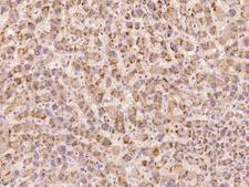 TEX9 Antibody - Immunochemical staining of human TEX9 in human liver with rabbit polyclonal antibody at 1:500 dilution, formalin-fixed paraffin embedded sections.