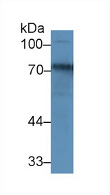 TF / Transferrin Antibody