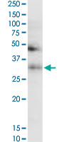 TF / Transferrin Antibody - TF monoclonal antibody (M08), clone 1C2. Western Blot analysis of TF expression in HeLa.