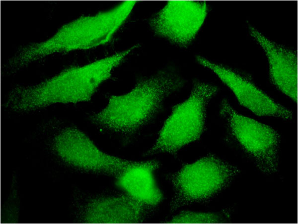 TF / Transferrin Antibody - Immunofluorescence of monoclonal antibody to TF on HeLa cell . [antibody concentration 10 ug/ml]