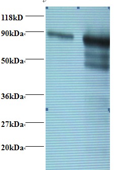 TF / Transferrin Antibody - Western blot of Rat Transferrin antibody at 2 ug/ml. Lane 1: Rat Transferrin at 0.1 mg/ml. Lane 2: Rat Transferrin at10 ug/ml. Secondary: Goat polyclonal to Rabbit IgG at 1:15000 dilution. Predicted band size: 77 kDa. Observed band size: 80 kDa.  This image was taken for the unconjugated form of this product. Other forms have not been tested.