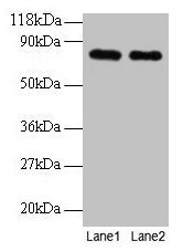 TF / Transferrin Antibody - Western blot All lanes: Rat Transferrin antibody at 2µg/ml Lane 1: Rat Transferrin at 0.1 mg/ml Lane 2: Rat Transferrin at10 /mlSecondary Secondary Goat polyclonal to rabbit IgG at 1/15000 dilution Predicted band size: 77, 55 kDa Observed band size: 77 kDa
