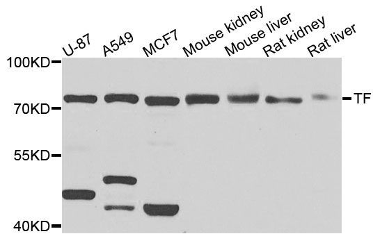 TF / Transferrin Antibody - Western blot analysis of extracts of various cell lines, using TF antibody at 1:1000 dilution. The secondary antibody used was an HRP Goat Anti-Rabbit IgG (H+L) at 1:10000 dilution. Lysates were loaded 25ug per lane and 3% nonfat dry milk in TBST was used for blocking. An ECL Kit was used for detection and the exposure time was 30s.