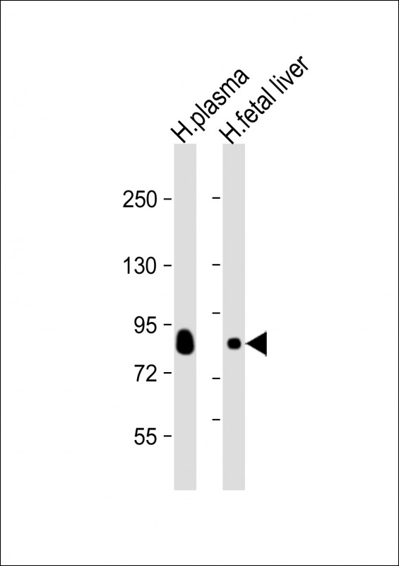 TF / Transferrin Antibody - All lanes: Anti-Transferrin Antibody at 1:2000 dilution Lane 1: human plasma lysate Lane 2: human fetal liver lysate Lysates/proteins at 20 µg per lane. Secondary Goat Anti-Rabbit IgG, (H+L), Peroxidase conjugated at 1/10000 dilution. Predicted band size: 77kDa Blocking/Dilution buffer: 5% NFDM/TBST.