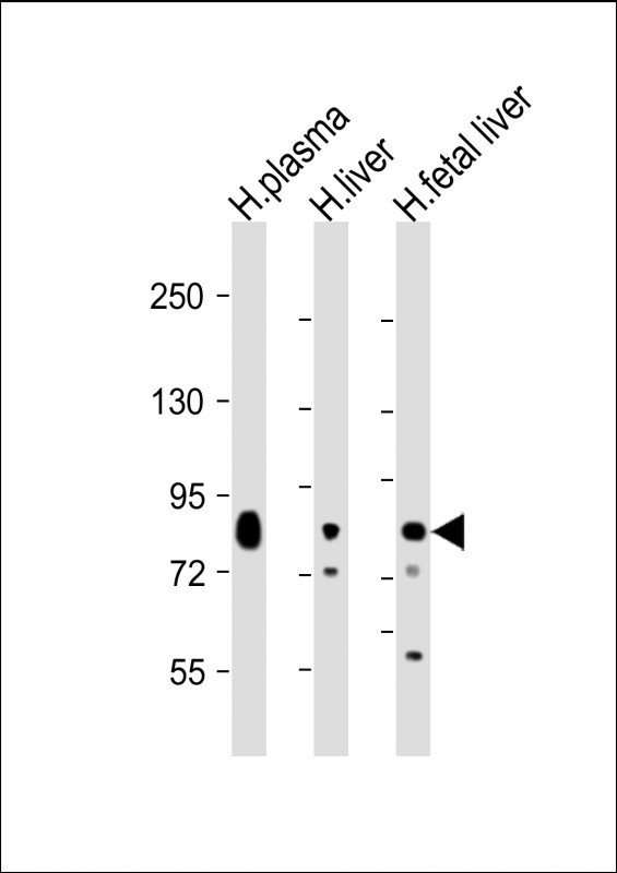 TF / Transferrin Antibody - All lanes: Anti-Transferrin Antibody at 1:2000 dilution Lane 1: human plasma lysate Lane 2: human liver lysate Lane 3: human fetal liver lysate Lysates/proteins at 20 µg per lane. Secondary Goat Anti-Rabbit IgG, (H+L), Peroxidase conjugated at 1/10000 dilution. Predicted band size: 77 kDa Blocking/Dilution buffer: 5% NFDM/TBST.
