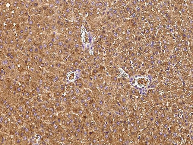 TF / Transferrin Antibody - Immunochemical staining of rat Tf in rat liver with rabbit polyclonal antibody at 1:1000 dilution, formalin-fixed paraffin embedded sections.