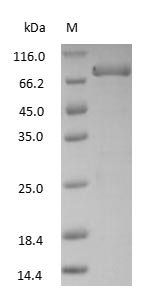 TF / Transferrin Protein - (Tris-Glycine gel) Discontinuous SDS-PAGE (reduced) with 5% enrichment gel and 15% separation gel.