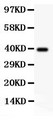 TFAP2A / AP-2 Antibody - AP2 alpha antibody Western blot. All lanes: Anti AP2A at 0.5 ug/ml. WB: Recombinant Human AP2A Protein 0.5ng. Predicted band size: 38 kD. Observed band size: 38 kD.