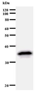 TFAP2A / AP-2 Antibody - Western blot of immunized recombinant protein using TFAP2A antibody.