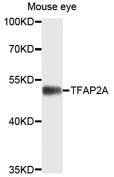 TFAP2A / AP-2 Antibody - Western blot analysis of extracts of mouse eye, using TFAP2A antibody at 1:1000 dilution. The secondary antibody used was an HRP Goat Anti-Rabbit IgG (H+L) at 1:10000 dilution. Lysates were loaded 25ug per lane and 3% nonfat dry milk in TBST was used for blocking. An ECL Kit was used for detection and the exposure time was 15s.