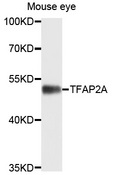 TFAP2A / AP-2 Antibody - Western blot analysis of extracts of mouse eye, using TFAP2A antibody at 1:1000 dilution. The secondary antibody used was an HRP Goat Anti-Rabbit IgG (H+L) at 1:10000 dilution. Lysates were loaded 25ug per lane and 3% nonfat dry milk in TBST was used for blocking. An ECL Kit was used for detection and the exposure time was 15s.