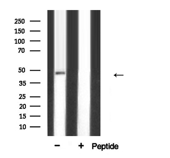 TFAP2A / AP-2 Antibody - Western blot analysis of AP 2 expression in COLO205 cells