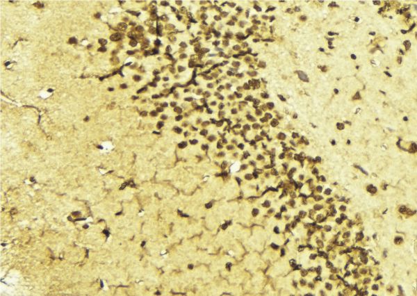 TFAP2A / AP-2 Antibody - 1:100 staining mouse brain tissue by IHC-P. The sample was formaldehyde fixed and a heat mediated antigen retrieval step in citrate buffer was performed. The sample was then blocked and incubated with the antibody for 1.5 hours at 22°C. An HRP conjugated goat anti-rabbit antibody was used as the secondary.