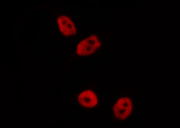 TFAP2A / AP-2 Antibody - Staining A431 cells by IF/ICC. The samples were fixed with PFA and permeabilized in 0.1% Triton X-100, then blocked in 10% serum for 45 min at 25°C. The primary antibody was diluted at 1:200 and incubated with the sample for 1 hour at 37°C. An Alexa Fluor 594 conjugated goat anti-rabbit IgG (H+L) antibody, diluted at 1/600, was used as secondary antibody.