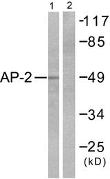 TFAP2A / AP-2 Antibody - Western blot analysis of extracts from COLO205 cells, using AP-2 antibody.