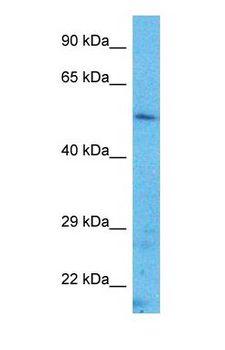 TFAP2A / AP-2 Antibody - Western blot of TFAP2A Antibody with human HeLa Whole Cell lysate.  This image was taken for the unconjugated form of this product. Other forms have not been tested.