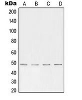 TFAP2A + TFAP2B Antibody - Western blot analysis of AP2 alpha/beta expression in HeLa (A); HepG2 (B); mouse brain (C); rat kidney (D) whole cell lysates.
