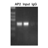 TFAP2A + TFAP2B Antibody - ChIP analysis of Cervical cancer cell lines lysate incubated for 12 hours at 4 C. Cross-linking (X-ChIP) using formaldehyde for 10 minutes. Detection step: Semiquantitative PCR. Positive control: Tumor cell lines HeLa. Negative control: Human primary keratinocytes.