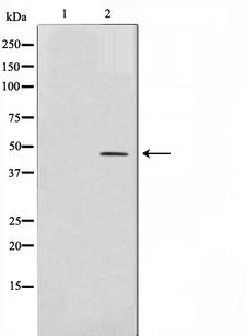TFAP2A + TFAP2B Antibody - Western blot analysis on COLO205 cell lysates using AP-2 antibody. The lane on the left is treated with the antigen-specific peptide.
