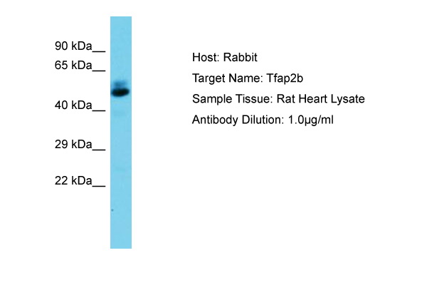 TFAP2B / AP2 Beta Antibody -  This image was taken for the unconjugated form of this product. Other forms have not been tested.