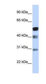TFAP2B / AP2 Beta Antibody - TFAP2B / AP2 Beta antibody Western blot of Transfected 293T cell lysate. This image was taken for the unconjugated form of this product. Other forms have not been tested.