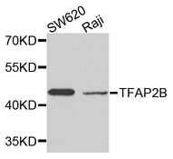 TFAP2B / AP2 Beta Antibody - Western blot analysis of extracts of various cells.