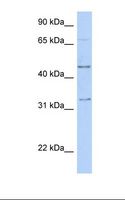 TFAP2B / AP2 Beta Antibody - Fetal muscle lysate. Antibody concentration: 1.0 ug/ml. Gel concentration: 12%.  This image was taken for the unconjugated form of this product. Other forms have not been tested.
