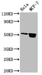 TFAP2B / AP2 Beta Antibody - Positive Western Blot detected in Hela whole cell lysate, MCF-7 whole cell lysate. All lanes: TFAP2B antibody at 3.2 µg/ml Secondary Goat polyclonal to rabbit IgG at 1/50000 dilution. Predicted band size: 51, 52 KDa. Observed band size: 51, 52 KDa