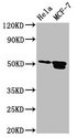 TFAP2B / AP2 Beta Antibody - Positive Western Blot detected in Hela whole cell lysate, MCF-7 whole cell lysate. All lanes: TFAP2B antibody at 3.2 µg/ml Secondary Goat polyclonal to rabbit IgG at 1/50000 dilution. Predicted band size: 51, 52 KDa. Observed band size: 51, 52 KDa