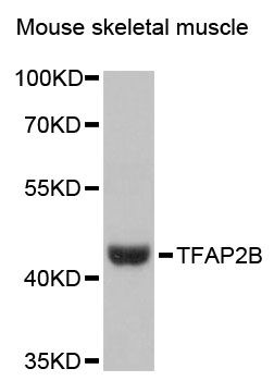 TFAP2B / AP2 Beta Antibody - Western blot analysis of extracts of mouse skeletal muscle, using TFAP2B antibody at 1:3000 dilution. The secondary antibody used was an HRP Goat Anti-Rabbit IgG (H+L) at 1:10000 dilution. Lysates were loaded 25ug per lane and 3% nonfat dry milk in TBST was used for blocking. An ECL Kit was used for detection and the exposure time was 90s.