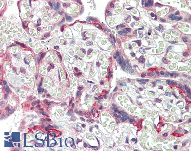 TFAP2B / AP2 Beta Antibody - Human, Placenta:Formalin-Fixed Paraffin-Embedded (FFPE).  This image was taken for the unconjugated form of this product. Other forms have not been tested.