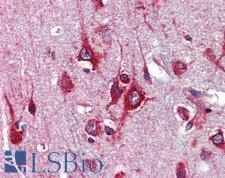 TFAP2C / AP2 Gamma Antibody - Anti-TFAP2C / AP2 Gamma antibody IHC of human brain, cortex. Immunohistochemistry of formalin-fixed, paraffin-embedded tissue after heat-induced antigen retrieval. Antibody concentration 5 ug/ml.  This image was taken for the unconjugated form of this product. Other forms have not been tested.