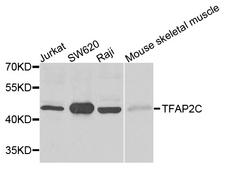 TFAP2C / AP2 Gamma Antibody - Western blot analysis of extracts of various cells.