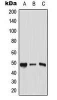 TFAP2C / AP2 Gamma Antibody - Western blot analysis of AP2 gamma expression in HeLa (A); Raw264.7 (B); PC12 (C) whole cell lysates.