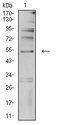TFAP2C / AP2 Gamma Antibody - Western blot analysis using TFAP2C mouse mAb against SK-Br-3 (1) cell lysate.