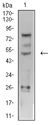 TFAP2C / AP2 Gamma Antibody - Western blot analysis using TFAP2C mouse mAb against SK-Br-3 (1) cell lysate.
