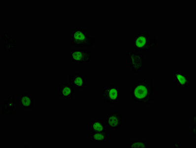 TFAP2C / AP2 Gamma Antibody - Immunofluorescence staining of MCF-7 cells with TFAP2C Antibody at 1:100, counter-stained with DAPI. The cells were fixed in 4% formaldehyde, permeabilized using 0.2% Triton X-100 and blocked in 10% normal Goat Serum. The cells were then incubated with the antibody overnight at 4°C. The secondary antibody was Alexa Fluor 488-congugated AffiniPure Goat Anti-Rabbit IgG(H+L).