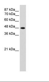 TFAP2C / AP2 Gamma Antibody - Transfected 293T Cell Lysate.  This image was taken for the unconjugated form of this product. Other forms have not been tested.