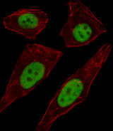 TFAP2D Antibody - Fluorescent image of A549 cell stained with TFAP2D Antibody. A549 cells were fixed with 4% PFA (20 min), permeabilized with Triton X-100 (0.1%, 10 min), then incubated with TFAP2D primary antibody (1:25, 1 h at 37°C). For secondary antibody, Alexa Fluor 488 conjugated donkey anti-rabbit antibody (green) was used (1:400, 50 min at 37°C). Cytoplasmic actin was counterstained with Alexa Fluor 555 (red) conjugated Phalloidin (7units/ml, 1 h at 37°C). TFAP2D immunoreactivity is localized to Nucleus significantly.