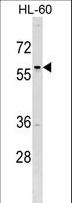 TFAP2D Antibody - TFAP2D Antibody western blot of HL-60 cell line lysates (35 ug/lane). The TFAP2D antibody detected the TFAP2D protein (arrow).