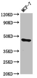TFAP2E Antibody - Western Blot Positive WB detected in: MCF-7 whole cell lysate All Lanes: TFAP2E antibody at 3.63µg/ml Secondary Goat polyclonal to rabbit IgG at 1/50000 dilution Predicted band size: 47 KDa Observed band size: 47 KDa